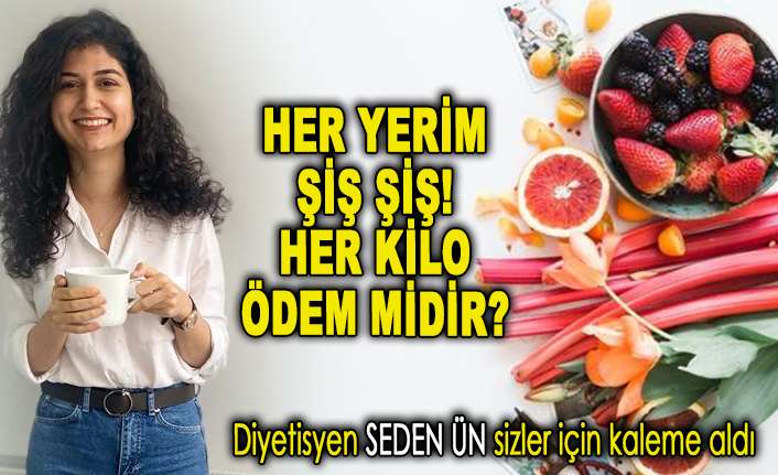 Her yerim şiş şiş! Her kilo ödem midir?
