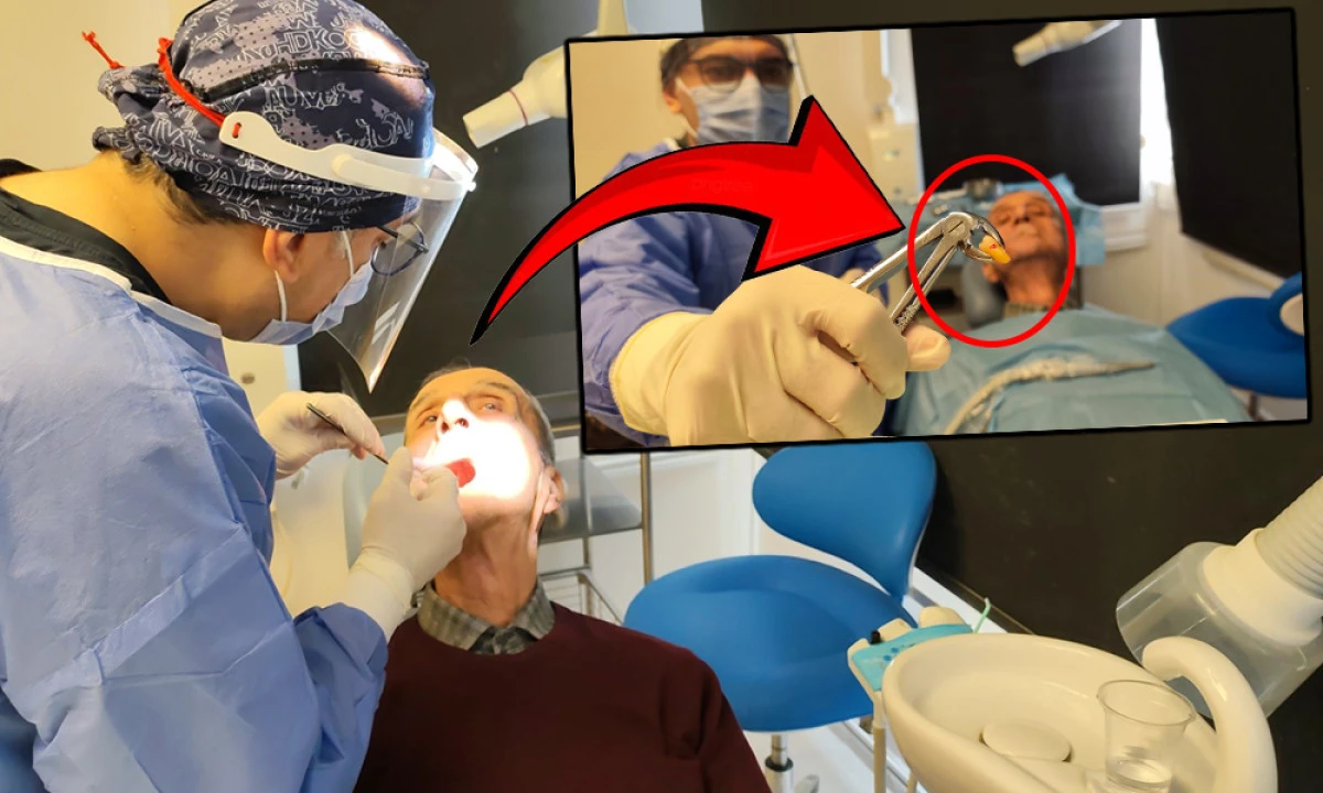 83 YAŞINDA 20'LİK DİŞ ŞOKU!