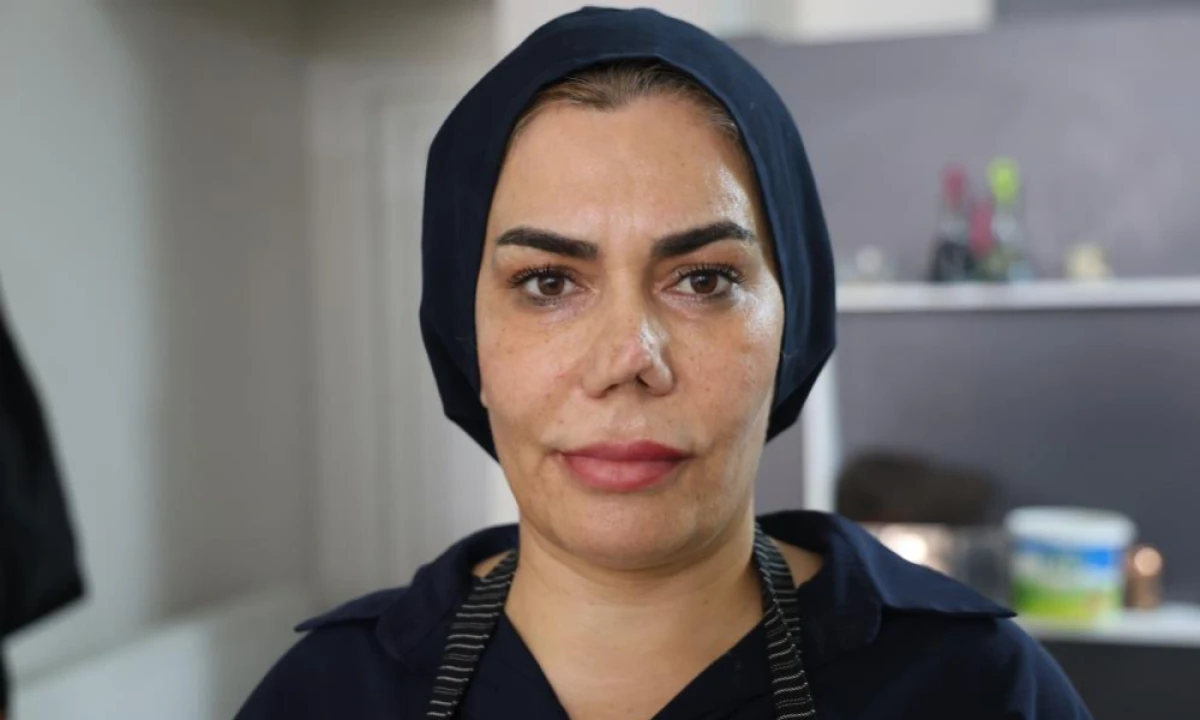 Bakım merkezinde burnu kırıldı, iyileşmek i&ccedil;in ge&ccedil;irdiği 4 operasyon sonrası hayatı kabusa d&ouml;nd&uuml;
