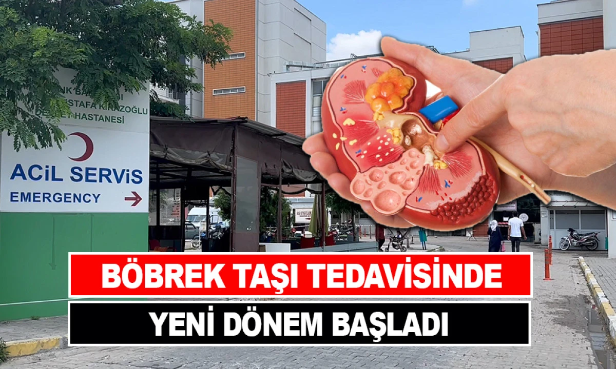 BÖBREK TAŞI TEDAVİSİNDE YENİ DÖNEM BAŞLADI