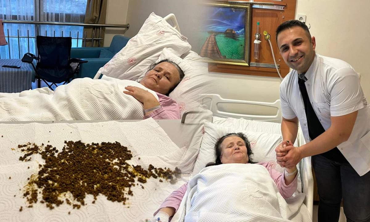 HASTADAN ÇIKAN TAŞ SAYISI HAYRETE DÜŞÜRDÜ